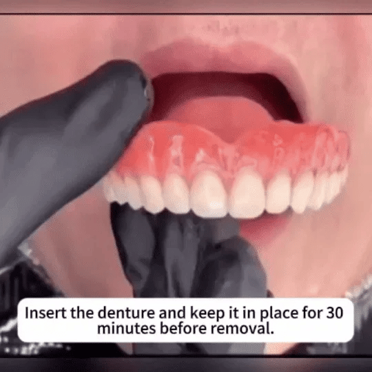 (OFFICIAL STORE) Medazy Custom-Fit Full Functional Dentures