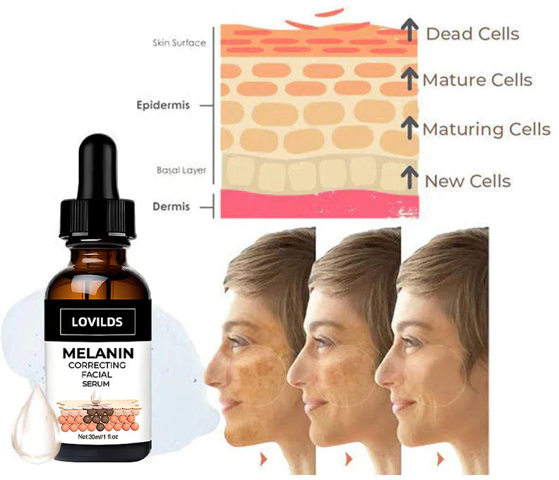 🌞 SUMMER BLOWOUT! 80% OFF! 🔥 LAST DAY!)✨Fast Dark Spot Remover-LOVILDS™ Melanin Correcting Facial Serum