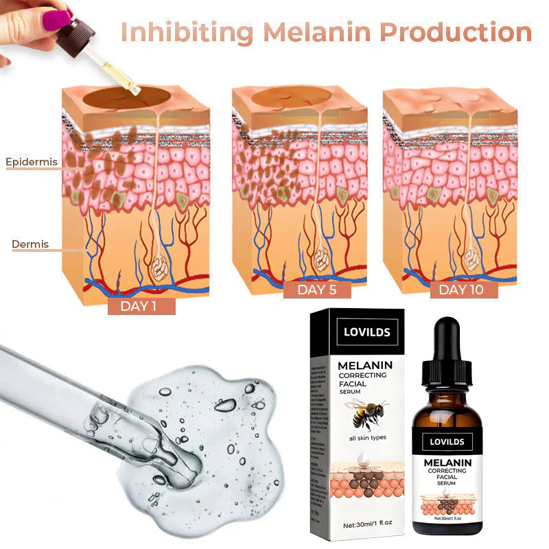 🌞 SUMMER BLOWOUT! 80% OFF! 🔥 LAST DAY!)✨Fast Dark Spot Remover-LOVILDS™ Melanin Correcting Facial Serum