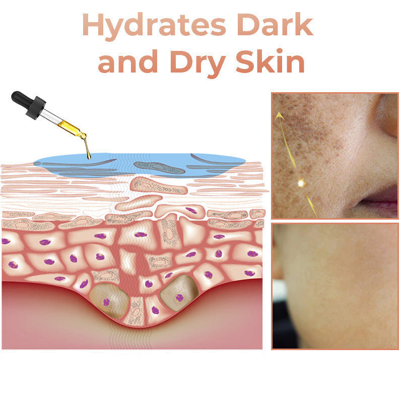 🌞 SUMMER BLOWOUT! 80% OFF! 🔥 LAST DAY!)✨Fast Dark Spot Remover-LOVILDS™ Melanin Correcting Facial Serum