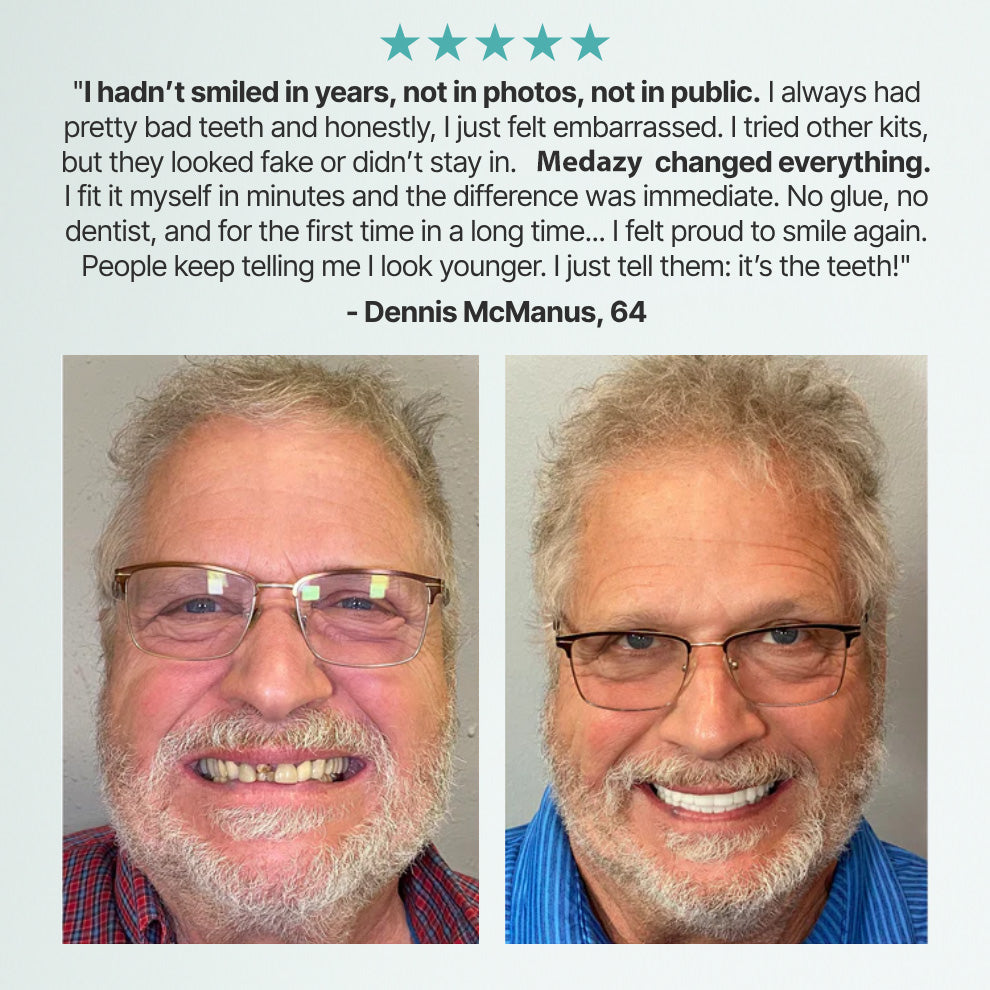 (OFFICIAL STORE) Medazy Custom-Fit Full Functional Dentures