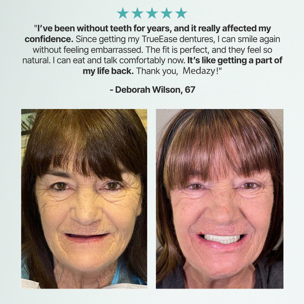 (OFFICIAL STORE) Medazy Custom-Fit Full Functional Dentures