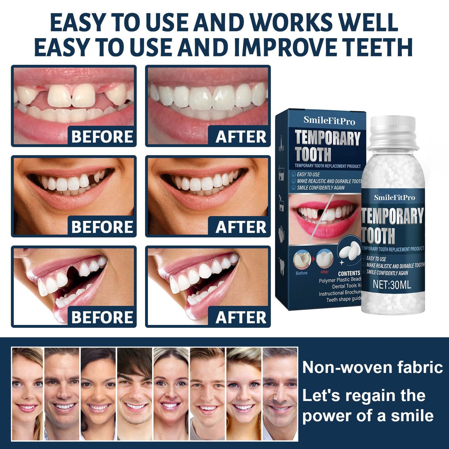 𦷠SmileFitPro⢠Dental Filling Gel ā Pain-Free, Drill-Free Cavity Solutionšš